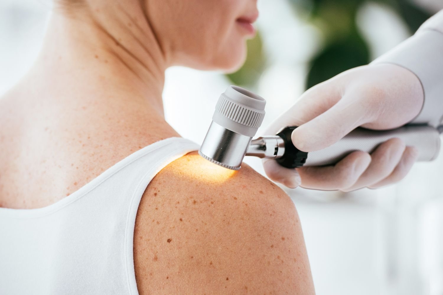 Dermatitis, psoriasis y eccemas