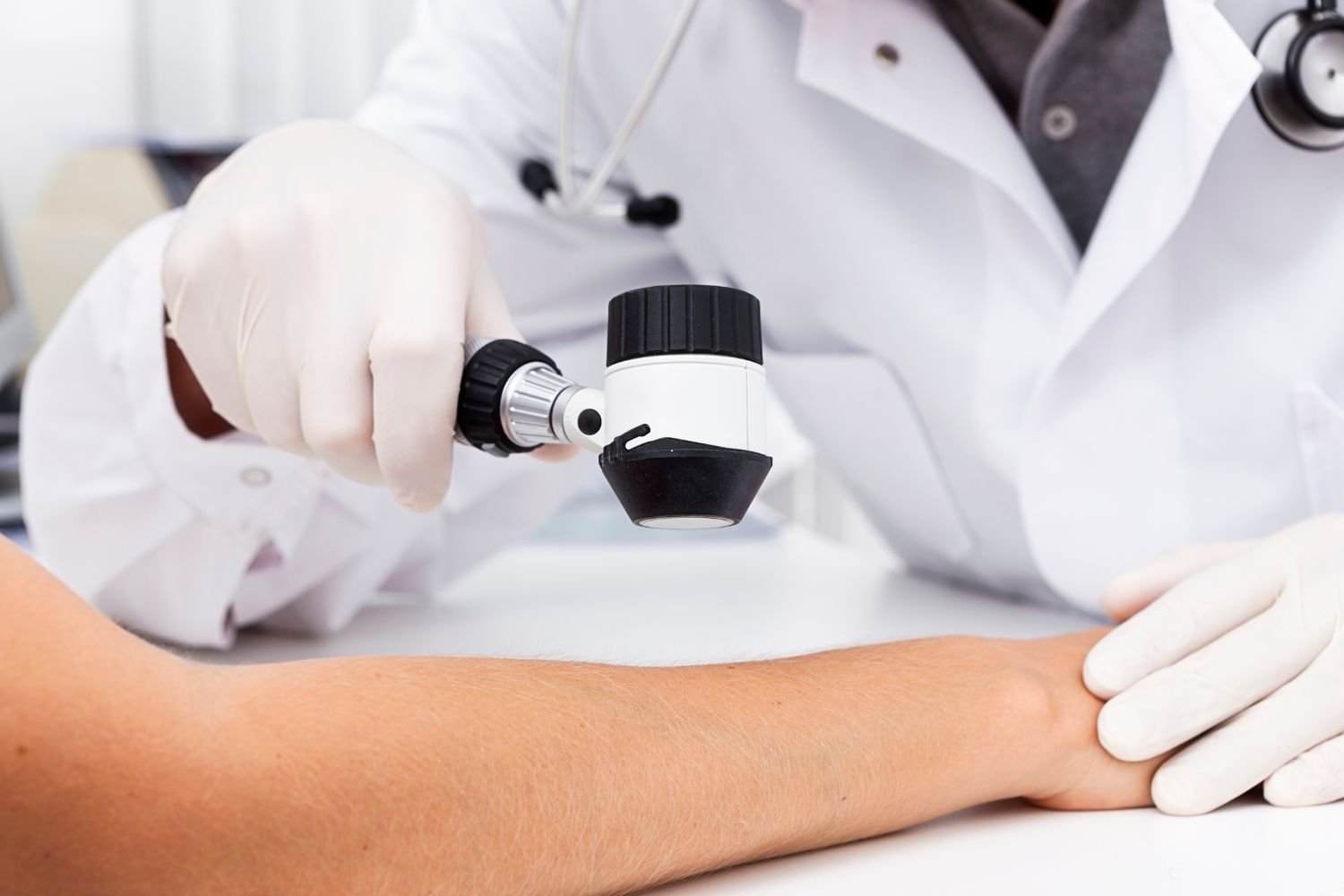 Diagnóstico dermatológico de lesiones cutáneas
